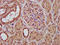 Regulatory Factor X Associated Ankyrin Containing Protein antibody, LS-C673596, Lifespan Biosciences, Immunohistochemistry paraffin image 