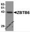 Zinc Finger And BTB Domain Containing 6 antibody, 6125, ProSci, Western Blot image 