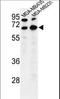 Bestrophin 2 antibody, LS-C156800, Lifespan Biosciences, Western Blot image 