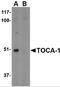 Formin Binding Protein 1 Like antibody, 4373, ProSci, Western Blot image 