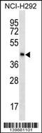 Sperm Equatorial Segment Protein 1 antibody, 60-308, ProSci, Western Blot image 