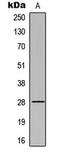 Troponin I3, Cardiac Type antibody, LS-C368570, Lifespan Biosciences, Western Blot image 