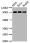 Ribosomal Protein S6 Kinase A1 antibody, CSB-RA618984A380phHU, Cusabio, Western Blot image 