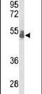 T-Box 1 antibody, PA5-26389, Invitrogen Antibodies, Western Blot image 