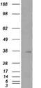 Hepatitis A Virus Cellular Receptor 2 antibody, ab47997, Abcam, Western Blot image 