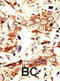 Insulin Receptor Related Receptor antibody, abx033581, Abbexa, Immunohistochemistry paraffin image 