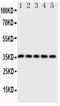 FosB Proto-Oncogene, AP-1 Transcription Factor Subunit antibody, PA1478, Boster Biological Technology, Western Blot image 