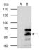 Retinoid X Receptor Alpha antibody, GTX113828, GeneTex, Immunoprecipitation image 