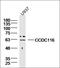 Coiled-Coil Domain Containing 116 antibody, orb2505, Biorbyt, Western Blot image 