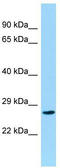 Coiled-Coil Domain Containing 28B antibody, TA331747, Origene, Western Blot image 