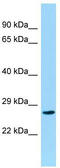 Coiled-Coil Domain Containing 28B antibody, TA331747, Origene, Western Blot image 