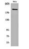 PHD Finger Protein 3 antibody, GTX16325, GeneTex, Western Blot image 