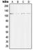 Striatin antibody, LS-C352888, Lifespan Biosciences, Western Blot image 