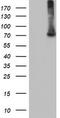 EPM2A Interacting Protein 1 antibody, CF501790, Origene, Western Blot image 