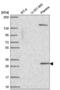 Scm Polycomb Group Protein Like 1 antibody, NBP2-55711, Novus Biologicals, Western Blot image 