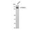 Proteasome 26S Subunit, Non-ATPase 2 antibody, A06642-2, Boster Biological Technology, Western Blot image 