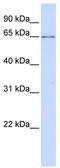 ALG6 Alpha-1,3-Glucosyltransferase antibody, TA341915, Origene, Western Blot image 