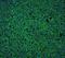 CD20 antibody, LS-C313533, Lifespan Biosciences, Immunofluorescence image 