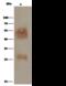 Basigin (Ok Blood Group) antibody, GTX02108, GeneTex, Immunoprecipitation image 