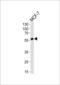 Activin A Receptor Like Type 1 antibody, LS-C344211, Lifespan Biosciences, Western Blot image 