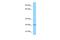 Atpbd1c antibody, A10292, Boster Biological Technology, Western Blot image 