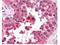 AHSA1 antibody, M05733, Boster Biological Technology, Immunohistochemistry paraffin image 