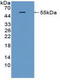 Triggering Receptor Expressed On Myeloid Cells 2 antibody, LS-C727757, Lifespan Biosciences, Western Blot image 