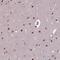 Aprataxin antibody, NBP2-39041, Novus Biologicals, Immunohistochemistry paraffin image 