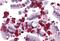 Cysteine And Histidine Rich Domain Containing 1 antibody, MBS246870, MyBioSource, Immunohistochemistry paraffin image 