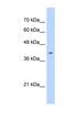 ST6 N-Acetylgalactosaminide Alpha-2,6-Sialyltransferase 6 antibody, NBP1-59959, Novus Biologicals, Western Blot image 