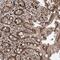 RNA Binding Motif Protein 17 antibody, NBP1-81202, Novus Biologicals, Immunohistochemistry frozen image 