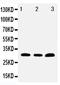 Toll Interacting Protein antibody, PA2005, Boster Biological Technology, Western Blot image 