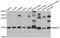 Small Nuclear Ribonucleoprotein D2 Polypeptide antibody, A12026, Boster Biological Technology, Western Blot image 