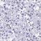 Rhomboid Like 3 antibody, HPA059607, Atlas Antibodies, Immunohistochemistry frozen image 