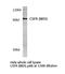 Colony Stimulating Factor 1 Receptor antibody, LS-C176408, Lifespan Biosciences, Western Blot image 