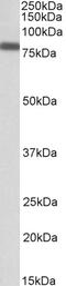 GM2 Ganglioside Activator antibody, 42-413, ProSci, Western Blot image 