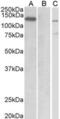 E3 ubiquitin-protein ligase MIB1 antibody, AHP2264, Bio-Rad (formerly AbD Serotec) , Immunohistochemistry paraffin image 