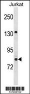 Ubiquitin Like With PHD And Ring Finger Domains 2 antibody, 60-042, ProSci, Western Blot image 