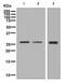 Fibroblast Growth Factor 7 antibody, ab131162, Abcam, Western Blot image 