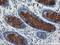 AP2M1 antibody, M06179-2, Boster Biological Technology, Immunohistochemistry paraffin image 