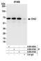 Checkpoint Kinase 2 antibody, A300-618A, Bethyl Labs, Immunoprecipitation image 