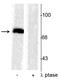Synapsin I antibody, P03794-1, Boster Biological Technology, Western Blot image 