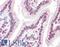 Karyopherin Subunit Alpha 4 antibody, LS-B2290, Lifespan Biosciences, Immunohistochemistry paraffin image 