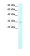 Msh Homeobox 1 antibody, orb329601, Biorbyt, Western Blot image 