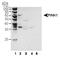 Serine/threonine-protein kinase PINK1, mitochondrial antibody, TA336309, Origene, Western Blot image 