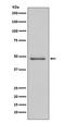 Dual specificity mitogen-activated protein kinase kinase 5 antibody, M03980, Boster Biological Technology, Western Blot image 