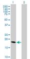 Corticotropin Releasing Hormone antibody, H00001392-B01P, Novus Biologicals, Western Blot image 