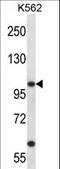 Potassium Voltage-Gated Channel Subfamily C Member 3 antibody, LS-C165414, Lifespan Biosciences, Western Blot image 