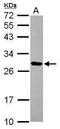 Mitochondrial Ribosomal Protein L9 antibody, GTX116779, GeneTex, Western Blot image 