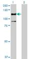 Serine/Threonine Kinase 31 antibody, H00056164-M02, Novus Biologicals, Western Blot image 